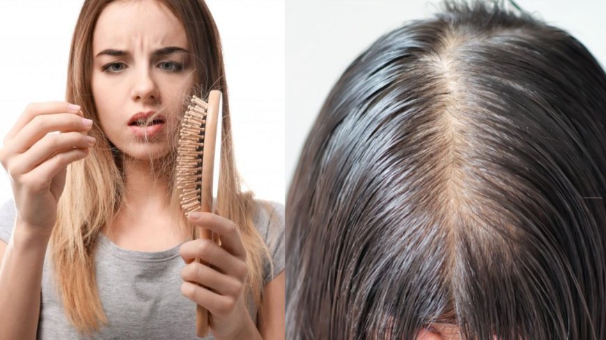 Hair loss concerns are rising among the public: Mostly caused by stress