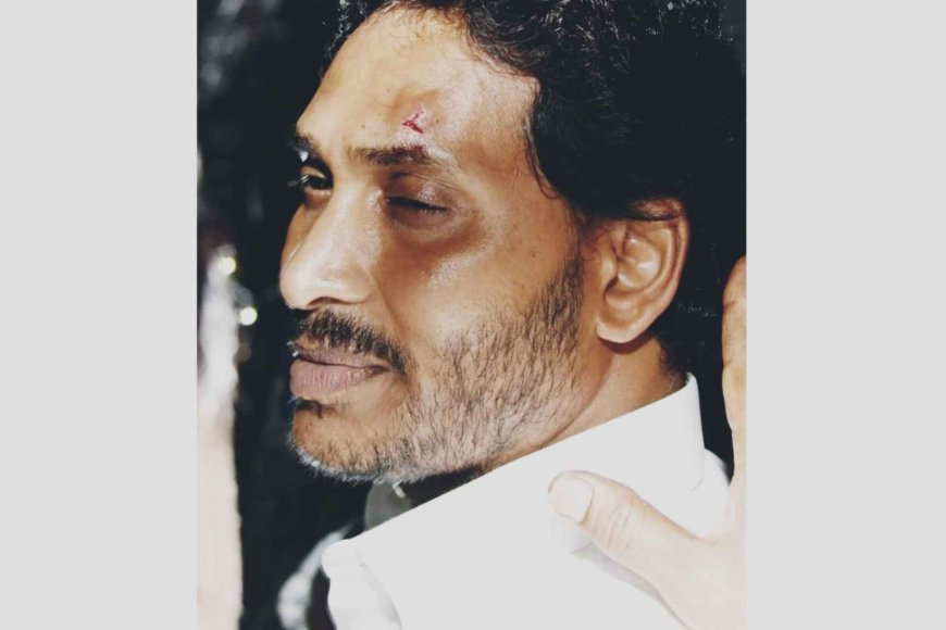 Andhra Pradesh CM YS Jagan Mohan Reddy Injured, Stones Thrown In Road Show