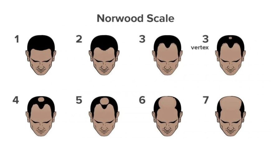 What is Causing Your Hair Fall? Take This Scientifically Backed Hair Loss Quiz