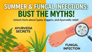 Summer & Fungal Infection! Unlock the myths with Ayurveda