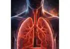 Half of India's Lung Cancer Cases Are Non-Smokers