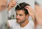 Scalp Care Is the New Skincare: Expert Tips for Healthy Hair